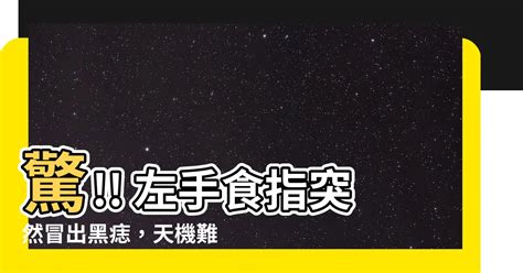 左手大拇指突然長痣|醫示警：「冒出5種痣」致死率超高！長在這部位最危。